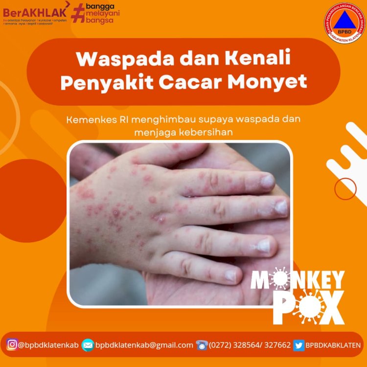 Waspada dan Kenali Penyakit Cacar Monyet/ Monkeypox