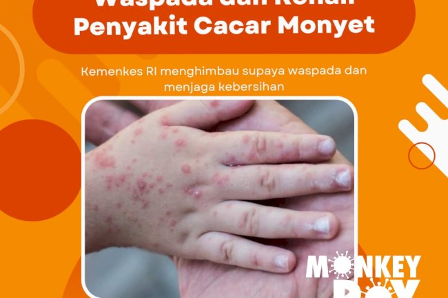 Waspada dan Kenali Penyakit Cacar Monyet/ Monkeypox